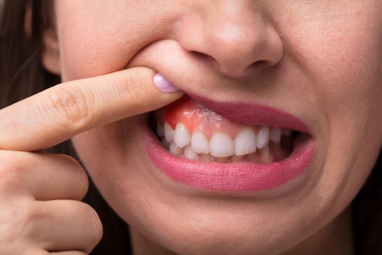 Woman Showing Gum problems in the camera