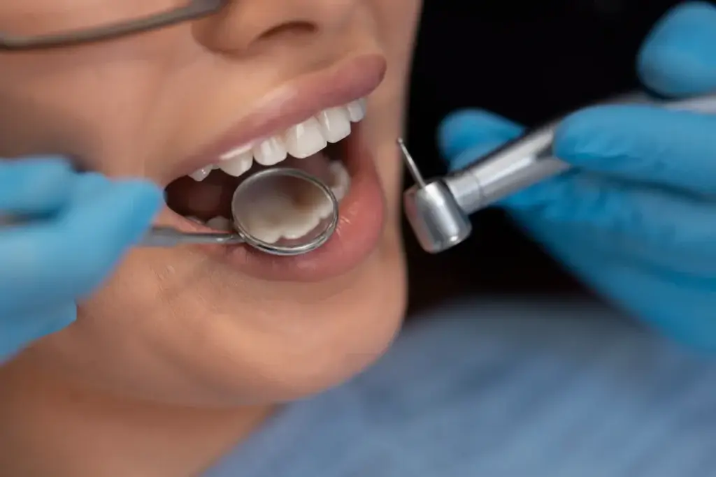 Dentist examining a patient's teeth with a dental mirror and instrument.